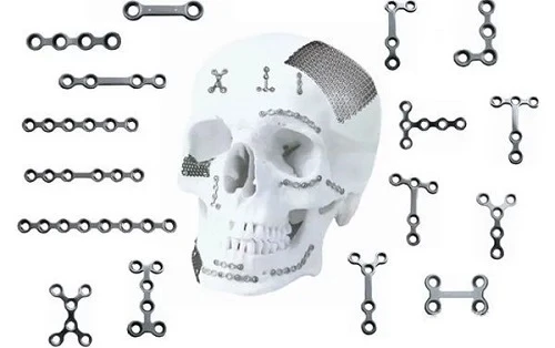After the maxillofacial contour surgery, should I take out the titanium plate and titanium nail After the maxillofacial contour surgery, should I take out the titanium plate and titanium nail